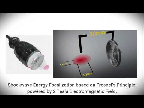 CTU S-Wave, 2022 version