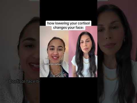 "Cortisol face" before & after