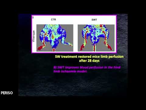 ICDT - Shock Waves and tissue regeneration - Roberto Frairia