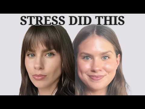 Cortisol Face: What It Is & How to Fix It