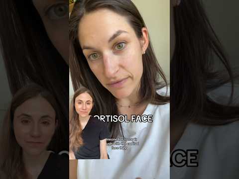 Dr Dray — "You don’t have cortisol face"
