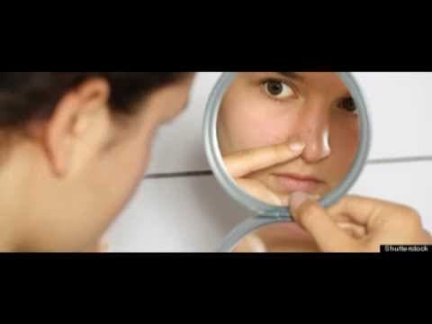 Body Dysmorphic Disorder - Psychologist Explains - Ben Buchanan