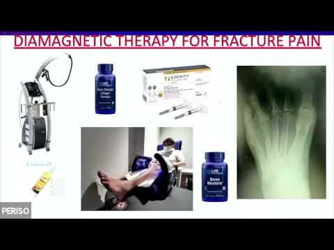 ICDT - Role of Diamagnetotherapy in fracture pain management: a case series - Yoon Kam Hon