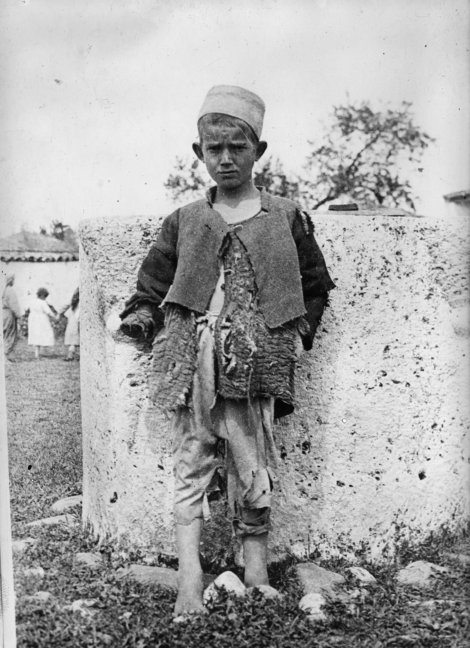 Boy who lost an arm in the Balkan War