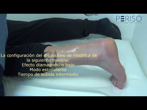 Dr. med Pietro Romeo - treatment with CTU S-Wave (spanish subtitel)
