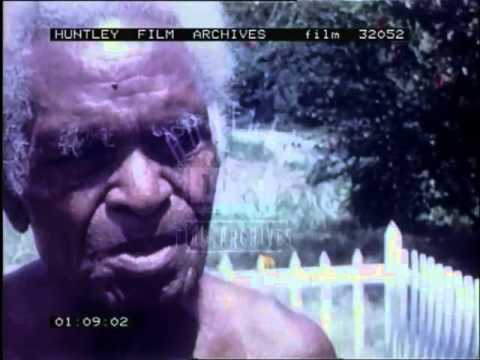 Sergeant Jacob Vouza shows his wartime bayonet wounds