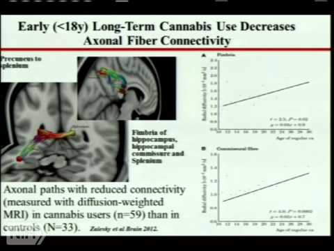 NIH Demystifying Medicine: marijuana, the highs and lows